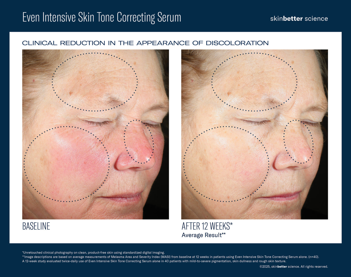 Eventone Intensive Skin Tone Correcting Serum