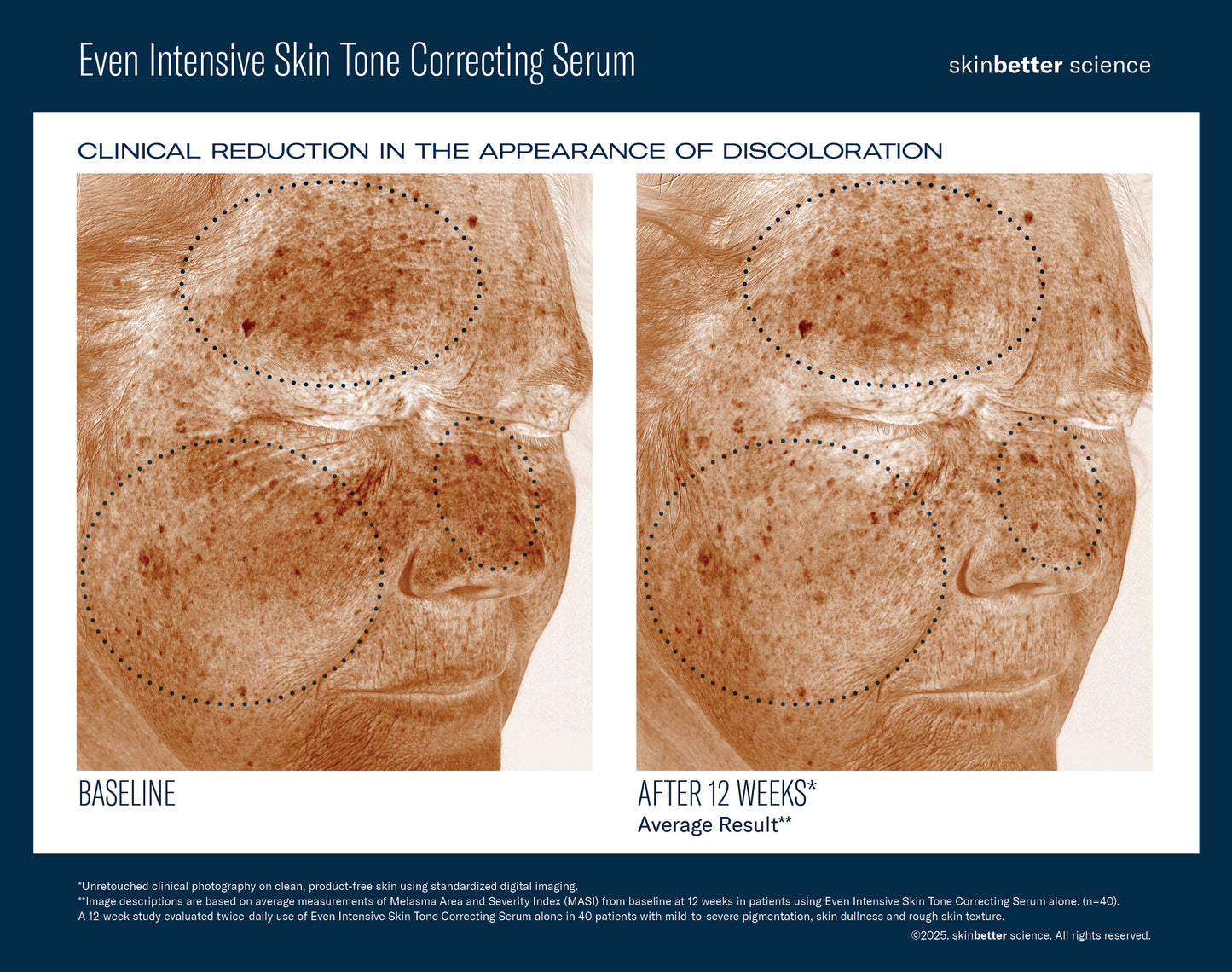 Eventone Intensive Skin Tone Correcting Serum
