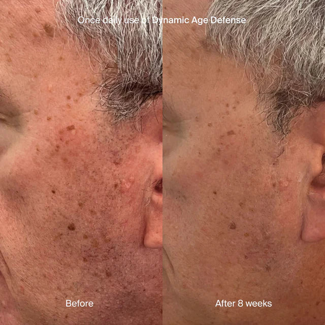 Pavise Dynamic Age Defense